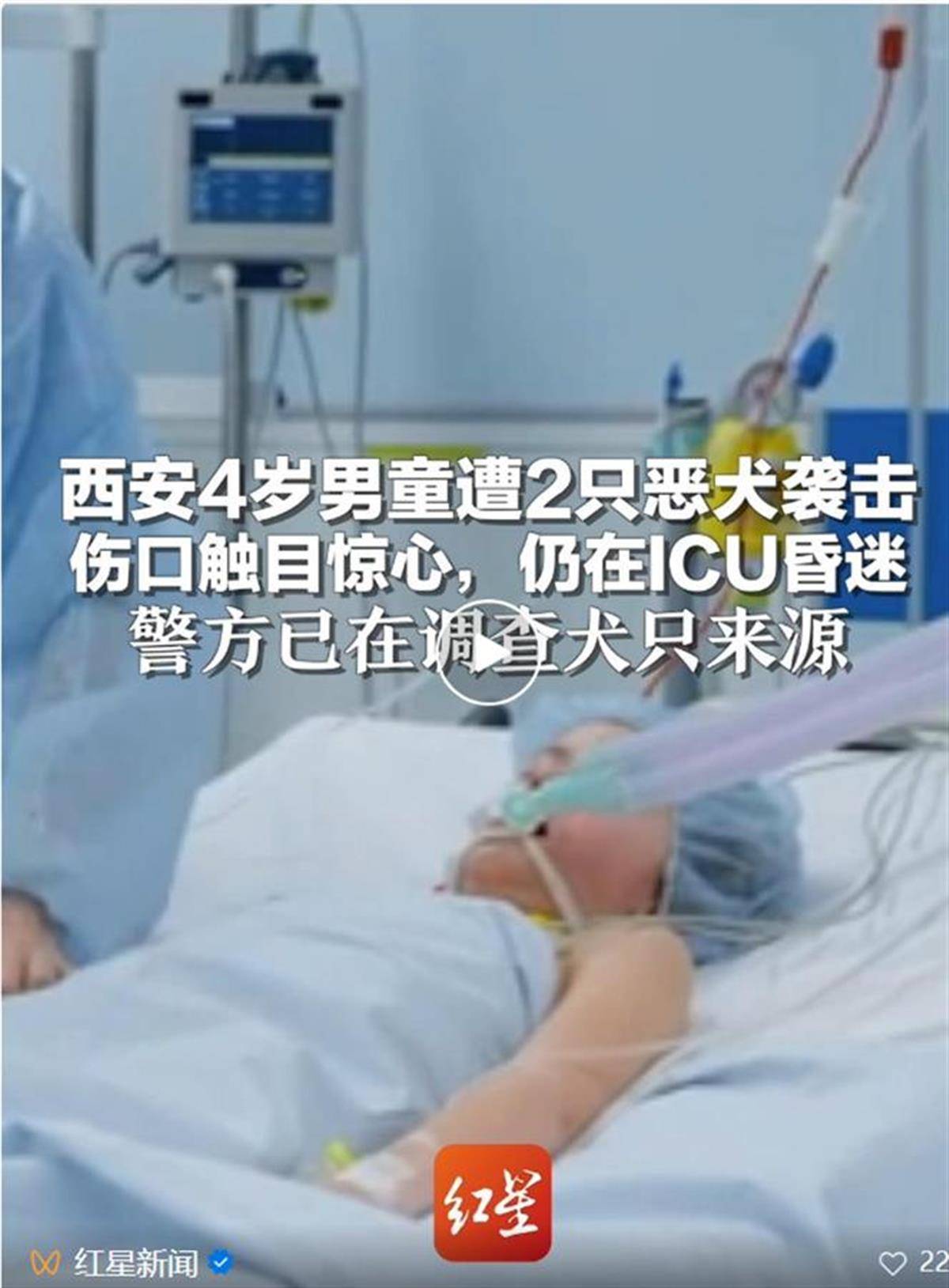 4歲男童遭惡犬襲擊住進(jìn)ICU，狗咬人為何就管不住？